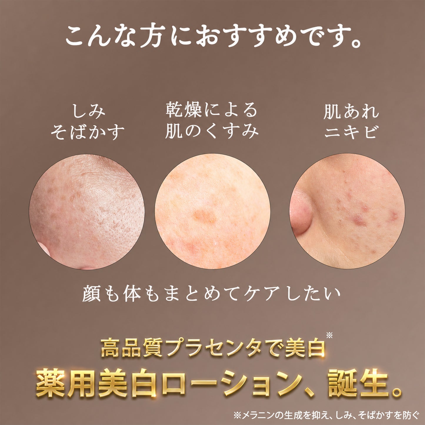 WHITExxx モイストケアローション 500mL